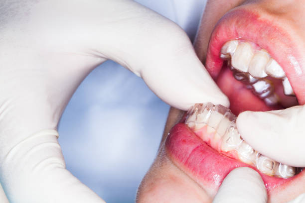 cosmetic dentist Adelaide