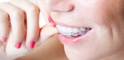 teeth straightening Adelaide