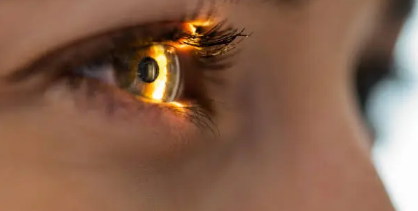 LASIK eye surgery
